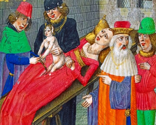 Medieval Surgeons Paint by numbers